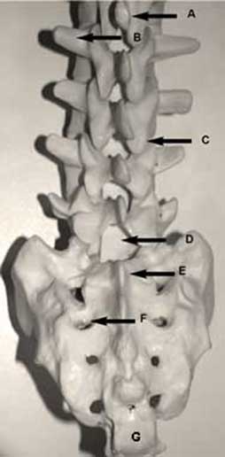 Posterior view of lower spine and sacrum showing anatomical labels