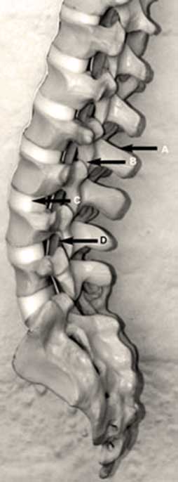 Lateral view of lumbar spine and sacrum showing anatomical labels