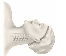 Supine positioning for anterior cervical discectomy