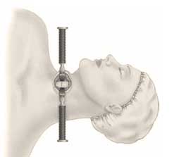 Anterior cervical spine surgical retractor positioning