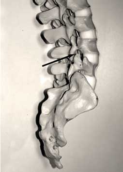 Lumbar selective nerve root block model