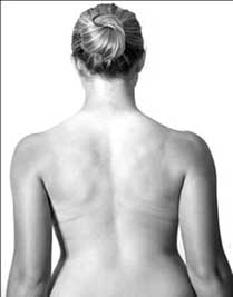 Back view of woman demonstrating posture and spinal alignment