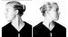 Woman demonstrating side-to-side active neck rotation exercise