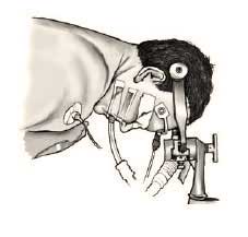 Prone positioning for posterior cervical spine surgery