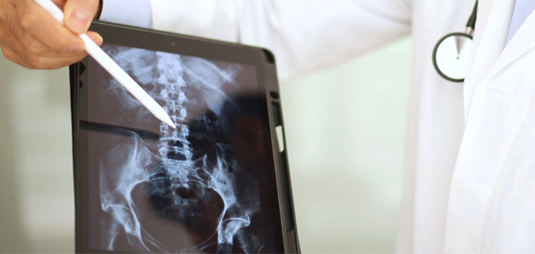 Doctor reviewing spinal X-ray